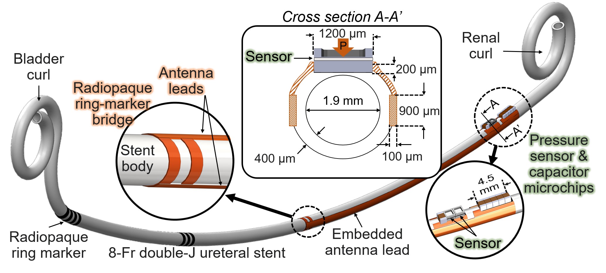 Smart Ureteral Stent Prototype 2